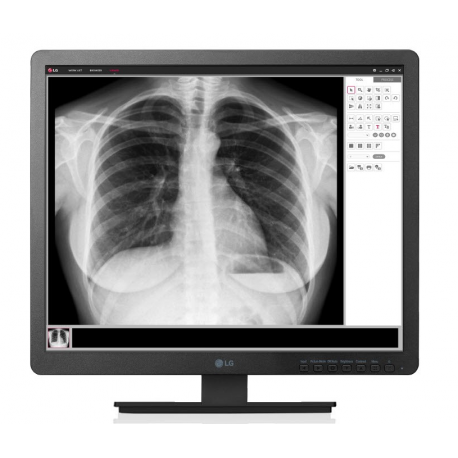 Monitor za medicino LG 19HK312C IPS